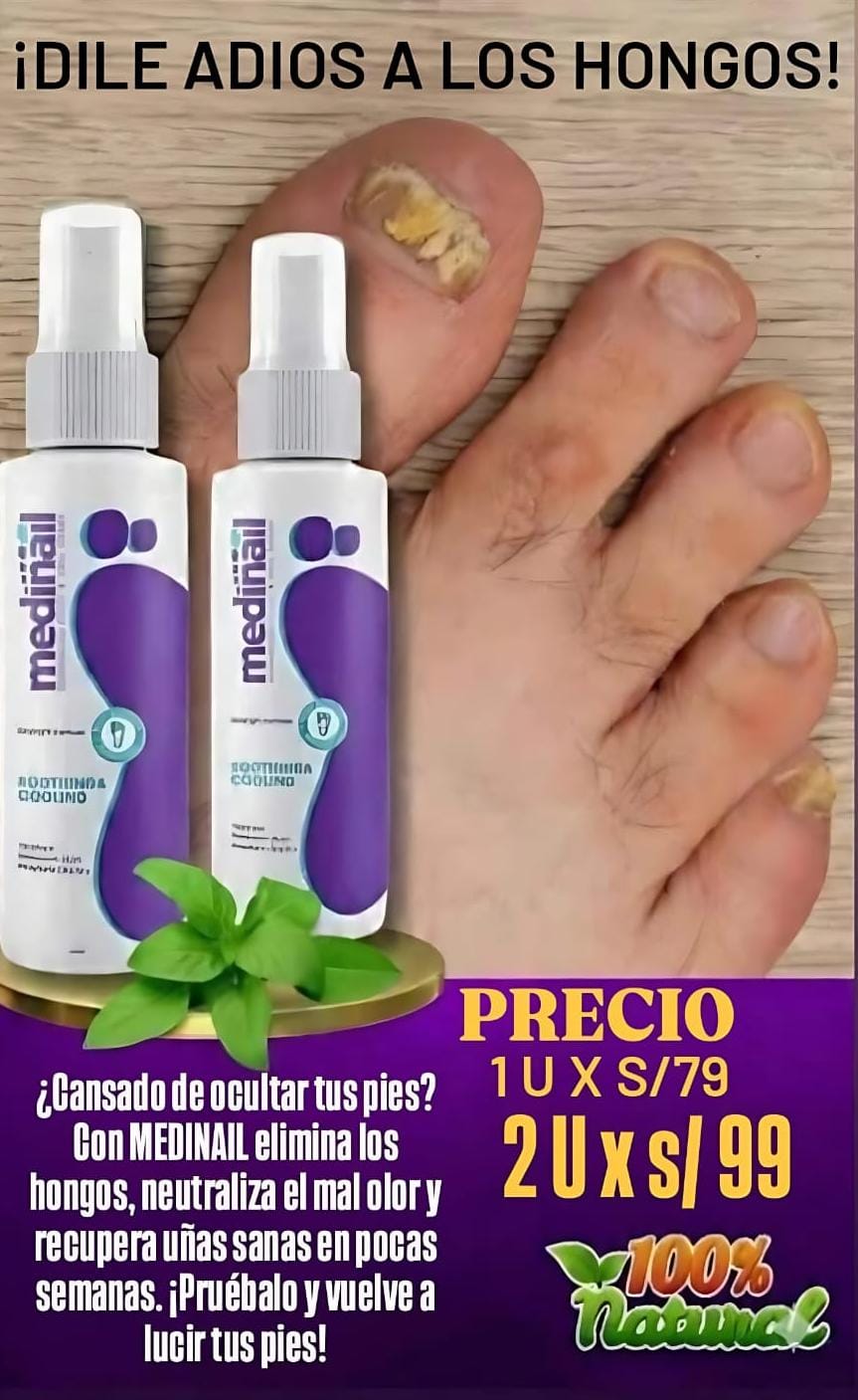 MEDINAIL – Spray Antifúngico de Acción Profunda para Pies y Uñas